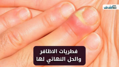تجربتي مع فطريات الاظافر والحل النهائي لها